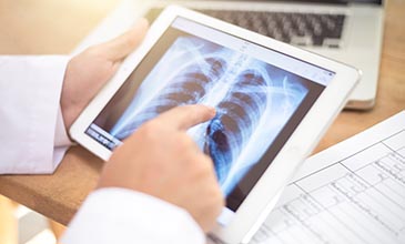 A physician looks at a pulmonary scan of the lungs.